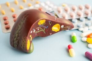 Fatty liver NAFLD