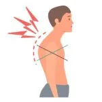 Upper cross syndrome