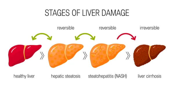 Stages of fatty liver